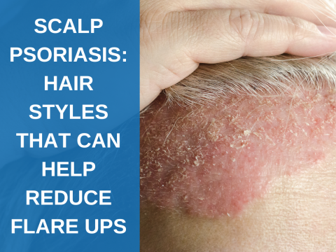7 Psoriasis Scalp Home Remedies: Relief & Management Tips